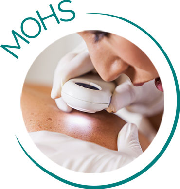 Mohs Skin Cancer Surgery